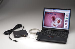 WELCH ALLYN IMAGE CAPTURE SYSTEM FOR VIDEO COLPOSCOPE